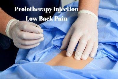 Prolotherapy Injections for Chronic Low-Back Pain | Dr. Vikram Rajguru ...