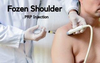 Platelet-rich-plasma-injections-for-frozen-shoulder