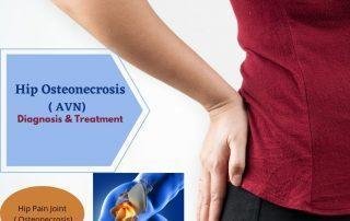 AVN-Hip-pain-treatment - in-pune