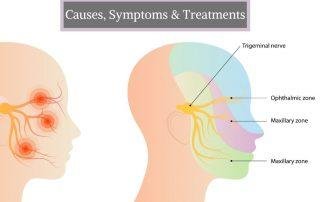 Trigeminal-neuralgia- treatment-in-pune