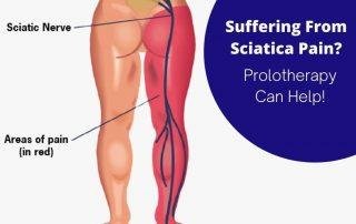 Sciatica Pain Treatment in hadapsar