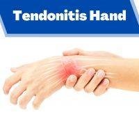 Tendonitis Hand | The Prolotherapy Clinic