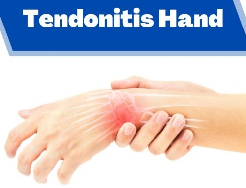 Tendonitis Hand