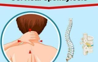 Cervical-Spondylosis-Treatment-in-Pune