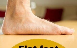 Flat-feet-Treatment-in- Pune