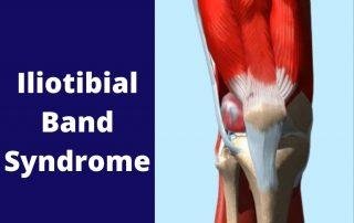 Iliotibial-band-syndrome- treatment-in-Pune