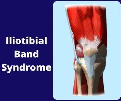 Iliotibial Band Syndrome | The Prolotherapy Clinic