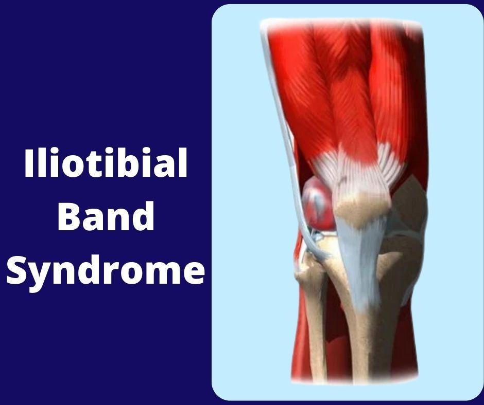iliotibial band syndrome treatment in Washington D.C., Maryland