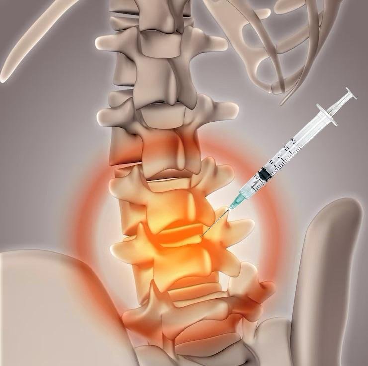 non-surgical-treatments-for-lower-back-pain-best-spine-specialist-in