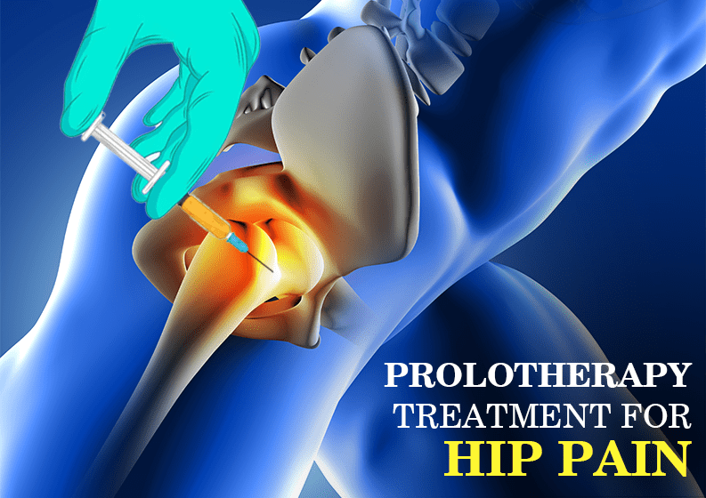 How to treat Hip Pain?  The Prolotherapy Clinic