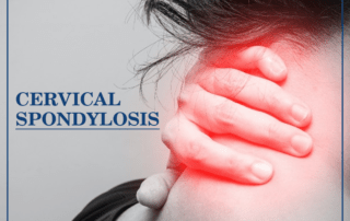 cervical-spondylosis-treatment