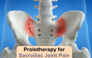 prolotherapy-treatment for-sacroiliac-joint-pain