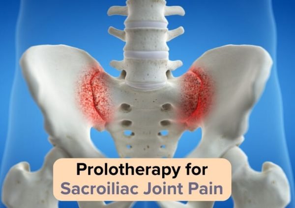 Sacroiliac Joint Pain - The Prolotherapy Clinic