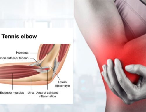 Can a Rotator Cuff Tear Cause Tennis Elbow?