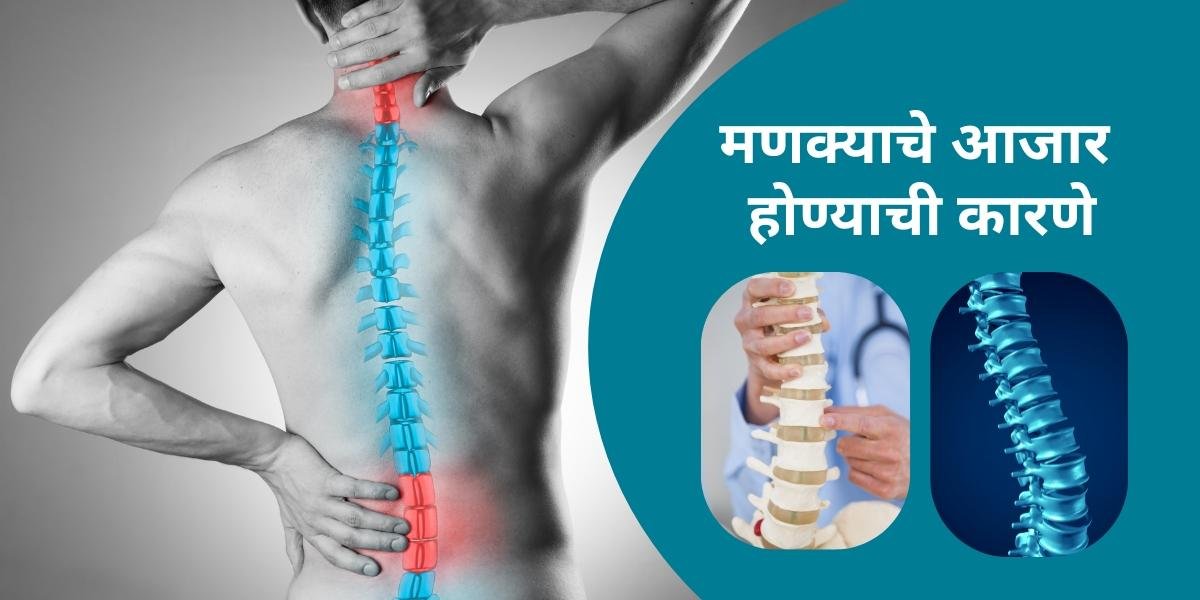 मणक्याचे आजार होण्याची कारणे | Causes of spine problem