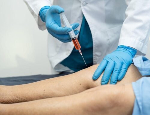 What is the Success Rate of Prolotherapy?