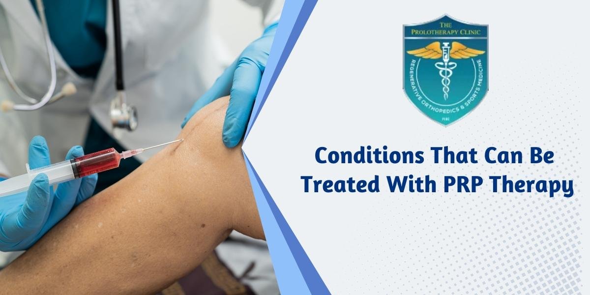 Conditions That Can Be Treated With PRP Therapy